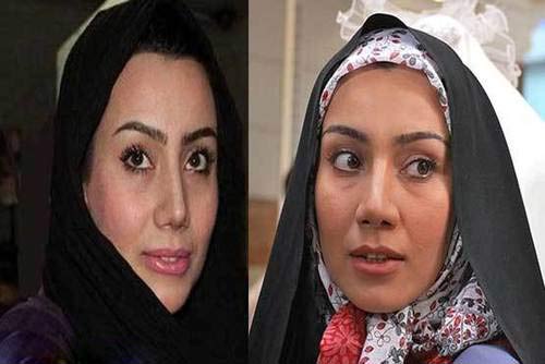 عکسهای لو رفته بازیگران زن ایرانی قبل از عمل زیبایی