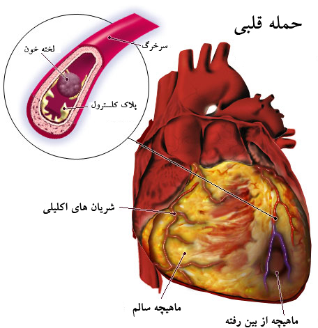 درباره قلب , معلومات درباره قلب , همه چیز درباره قلب انسان 
