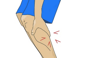 کشیدگی دردناک پشت ساق پا 