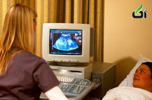 مراحل رشد جنین , در دوران بارداری چندبار برویم سونوگرافی , چند بار در بارداری سنو لازم است 