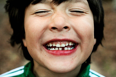 علت دیرکنده نشدن دندان های شیری؟ , کدام یک ازدندانهای شیری میریزد , دندون شیری پسر 8 ستله ام هنوز نریخته 