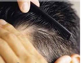 روشهای جلوگیری از ریزش موی ارثی , ریزش مو ارثی , دیجی کالامک برای ریزش موروموش ازمایش شده 