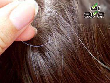 پیشنهاددکتردریاکناری برای رفع موی زایدبطریق سنتی , ایا گوجه سبز سبب سفیدی مو میشود , رفع سفیدی مو با داروهای گیاهی 