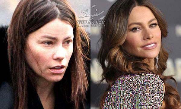 تغییر چهره بازیگران بعد عمل , قبل و بعد از عمل بازیگران هالیوود