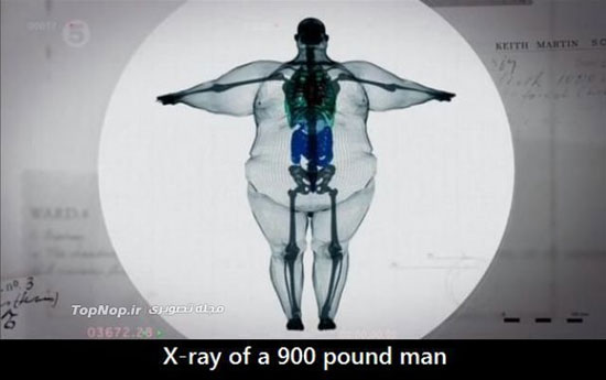تصویری ازچاق ترین آدم دنیا زیراشعه ایکس 