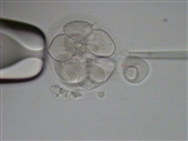 embryo-biopsy-2.jpg