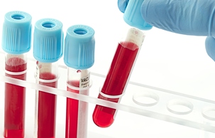 آزمایش خون , تفسیر آزمایش خون , ازمایش خون 