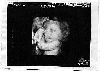 Pregnancy Ultrasound Picture : week 29