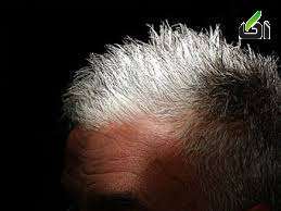 جلوگیری از سفید شدن مو , سیاه شدن موهای سفید , جلوگیری از سفیدی مو 