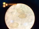 تخم فاسيولا هپاتيكا , Fasciola hepatica
