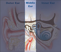 بیماری های گوش میانی