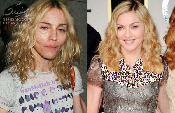 تغییر چهره بازیگران بعد عمل , قبل و بعد از عمل بازیگران هالیوود