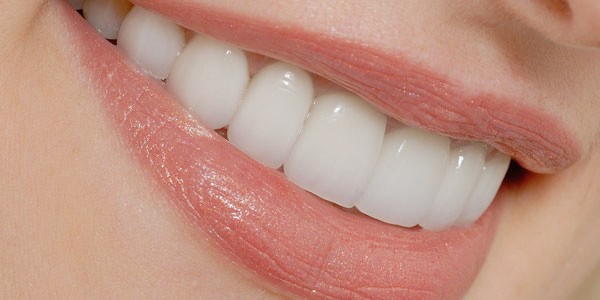 دندان های زیبا,دندان زیبا,دندان زیبایی