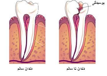 زخم زبان و دهان , زخم های دهانی , علت خونریزی زبان 