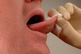 علت خوشک شدن دهان , درمان خشکی دهان , علت خشکی دهان از نظر طب سنتی 