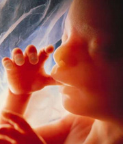 عوارض سقط غیر طبیعی بوسیله قرص , مقدارخونریزی درحین سقط عمدی یکماهه 