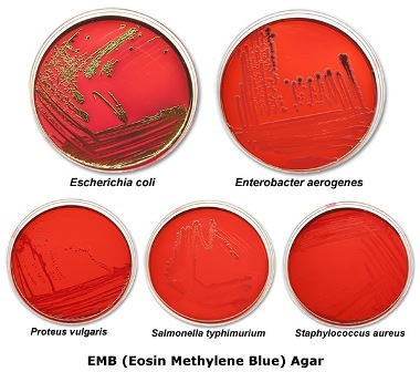 انواع کلنی های باکتری در محیط کشت افتراقی emb