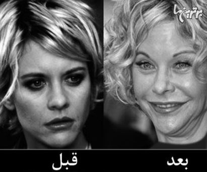 ,جراحی زیبایی, عکس قبل و بعد,  ستاره ها,اخبار بازیگران،اخبار چهره ها،دنیای ستاره ها