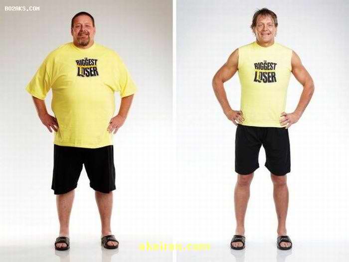 عکس های قبل و بعد از چاقی ,[categoriy]
