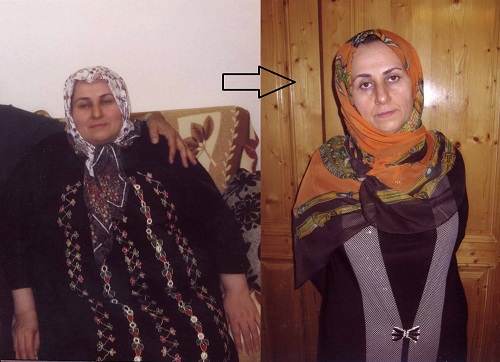 گفتگو با یکی از افراد موفق در کاهش وزن در رژیم "دکتر کرمانی"