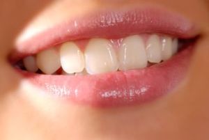 سفید کردن دندان ها با روش های طبیعی , سفسد کننده های طبییعی دندان , راهی طبیعی برای سفید شدن دندان 
