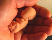 سقط جنین - چرا سقط جنین اهمیت دارد؟