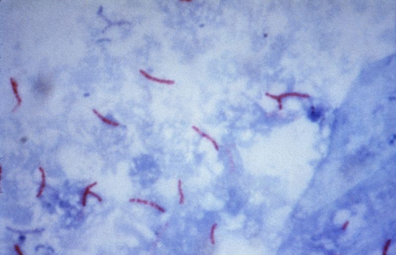 800px-Mycobacterium_tuberculosis_Ziehl-N