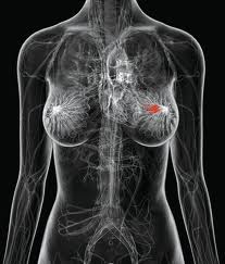 جلوگیری از سرطان سینه , راههای پیشگیری از سرطان سینه , پیشگیری از سرطان سینه 