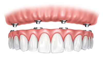 کلینیک فوق تخصصی دندان پزشکی 