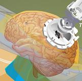 عمل جراحی مغز
