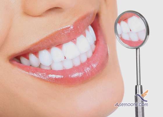 types of orthodontic procedures3 انواع روش های ارتودنسی