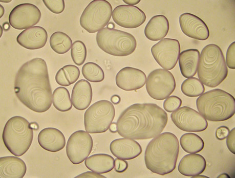  آمیلوپلاست‌ Amyloplasts