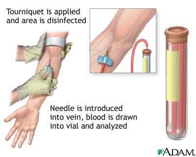 آزمایش خون - Blood Test 