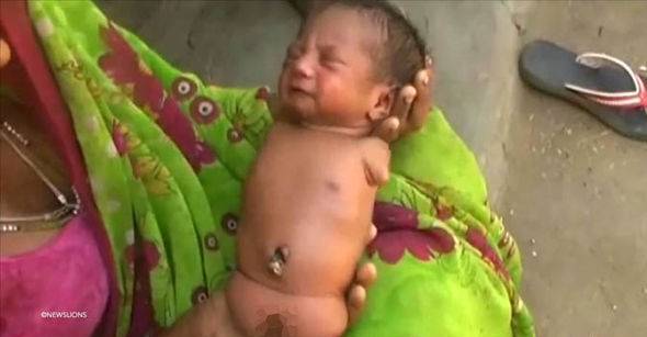 نوزاد بدون دست و پا