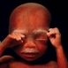 گزارش تصویری | مراحل رشد جنین از لقاح تا تولد