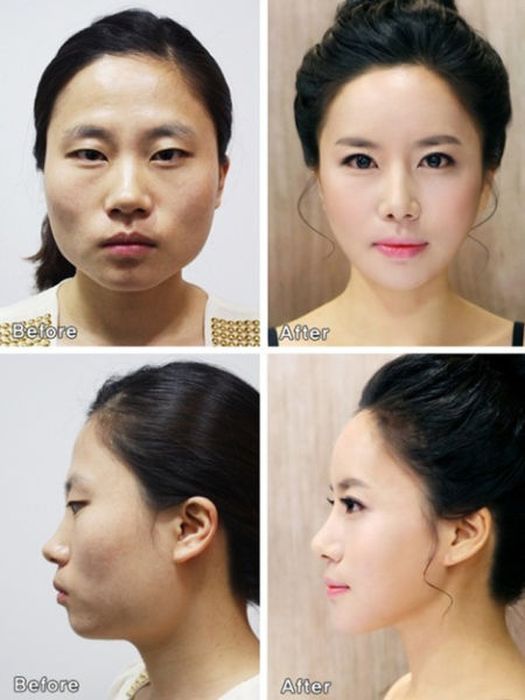 قبل و بعد از جراحی زیبایی