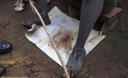 عکس: ختنه دسته‌جمعی در کنیا! (16+) وحشتناک,ختنه,کنیا,عکس های حوادث