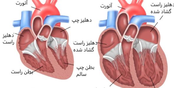 همه چیز درباره ی قلب انسان , تحقیق درباره ی قلب انسان , درباره ی قلب 
