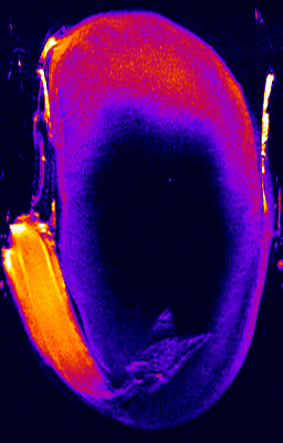 تصویر میکروسکوپی از جوانه زنی لوبیا تحت اثر هورمون1h nmr 