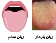 بیماری‌های زبان