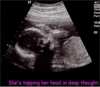 Pregnancy Ultrasound Picture : week 22