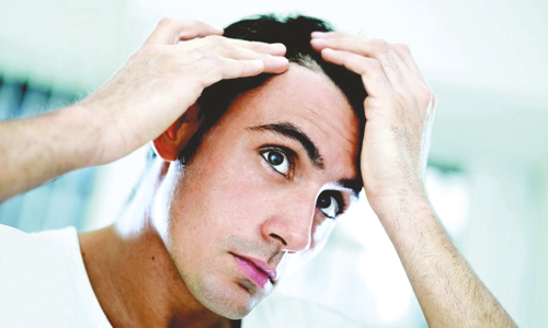 برای درمانطاسی چه کنیم , طول درمان ریزش مو بعد از مصرف دارو , درمان برای ریزش مو 
