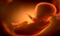 سقط جنین مجاز , غذای منع شده تریزومی تیپ ۲ , مواردمجازسقط 