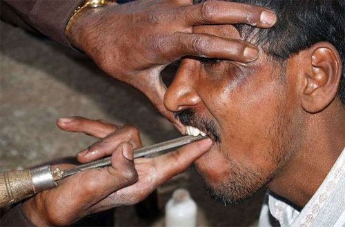 Street dentist in India