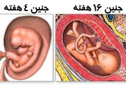 سونوگرافی جنین,سونوگرافی جنین پسر,سونوگرافی جنین دختر,بارداری و زایمان علائم بارداری علائم زایمان
