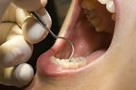 عواقب دندان فاسد در دهان 