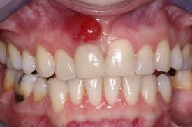 دانستنیهایی در مورد دهان و دندان (1)