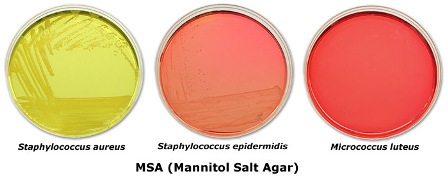 کلنی های باکتری ها در محیط مانیتول سالت آگار msa