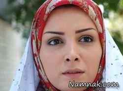 بازیگران زن ایرانی که عمل زیبایی انجام داده اند 