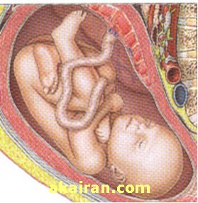 جنین من بیش از 500 تکان در روز دارد چرا , تکون خوردن جنین , تعبیر خواب تکان خوردن بچه در شکم 